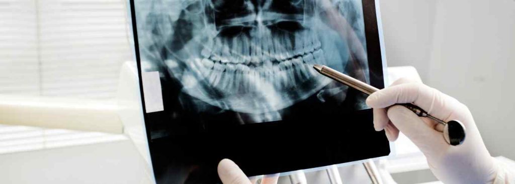Oral Surgery in uae